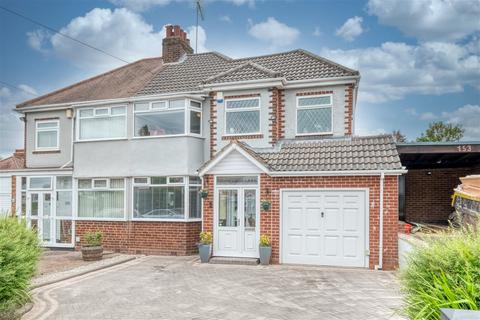 151 Castle Lane, Solihull, B92 8RW